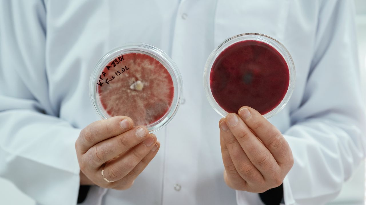 hematopoese extramedular