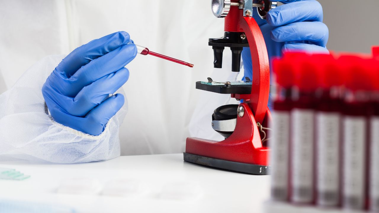 pós-graduação em análises clínicas e microbiologia 