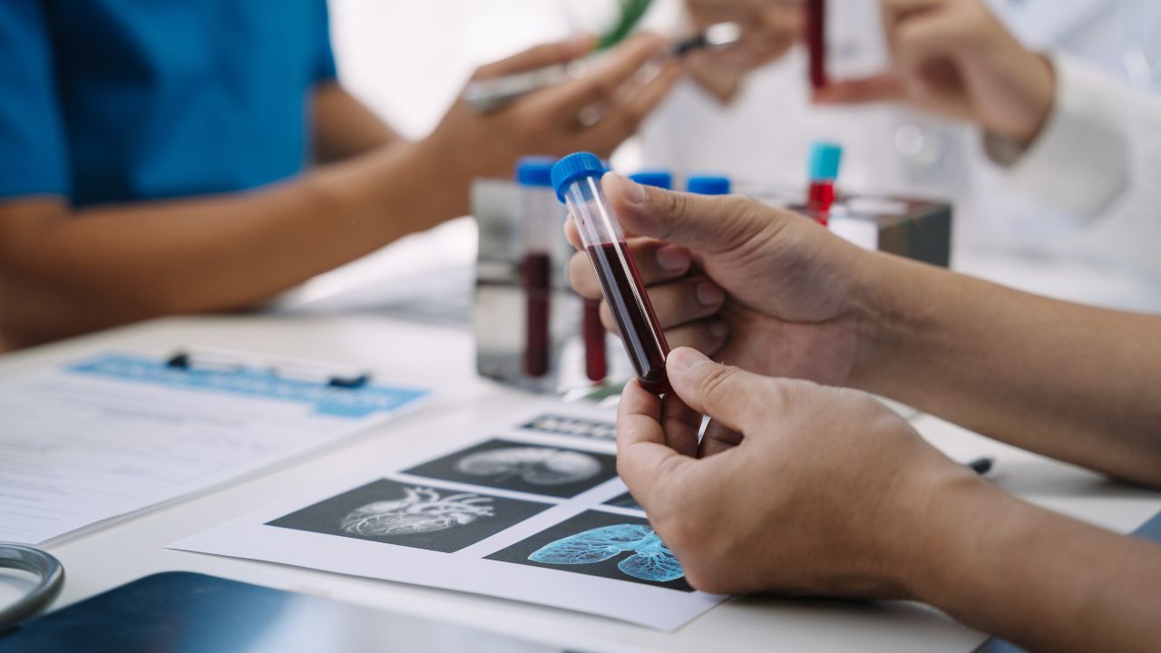 O que é um hematologista? Saiba mais sobre o profissional