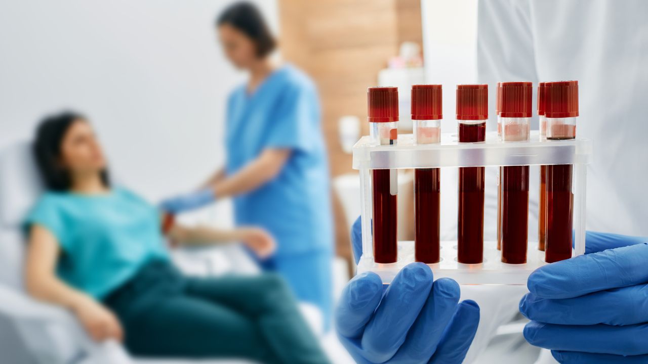 Hematologista: o que faz, cuida de que e quanto ganha