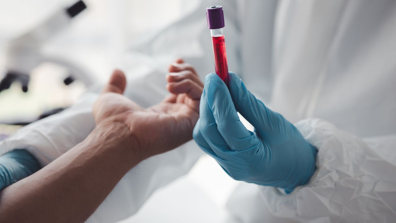 hematologista