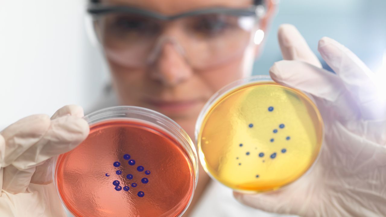 Qual a importância da microbiologia