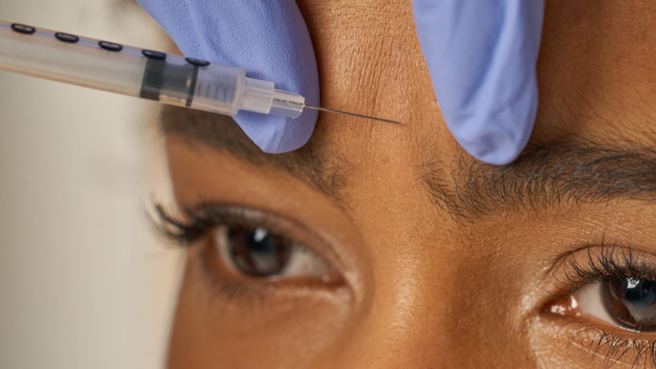 biomedicina estética pode aplicar botox biomedicina estética pode aplicar botox