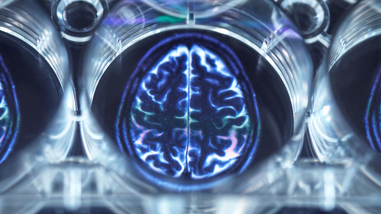 Neuroplasticidade cerebral