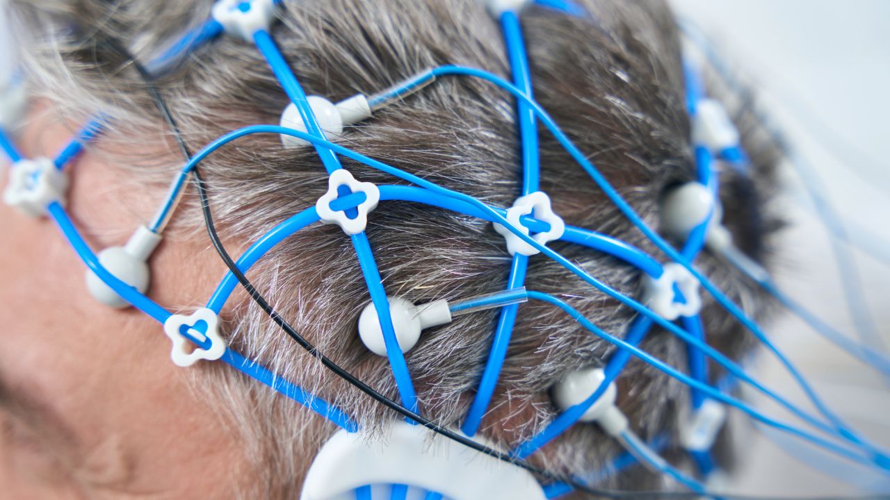 neurofeedback o que é