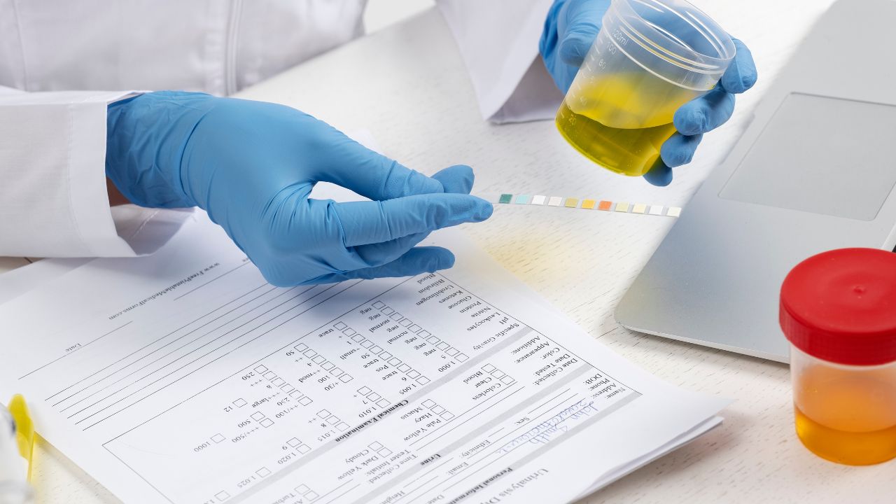 Urinálise e Parasitologia Clínica