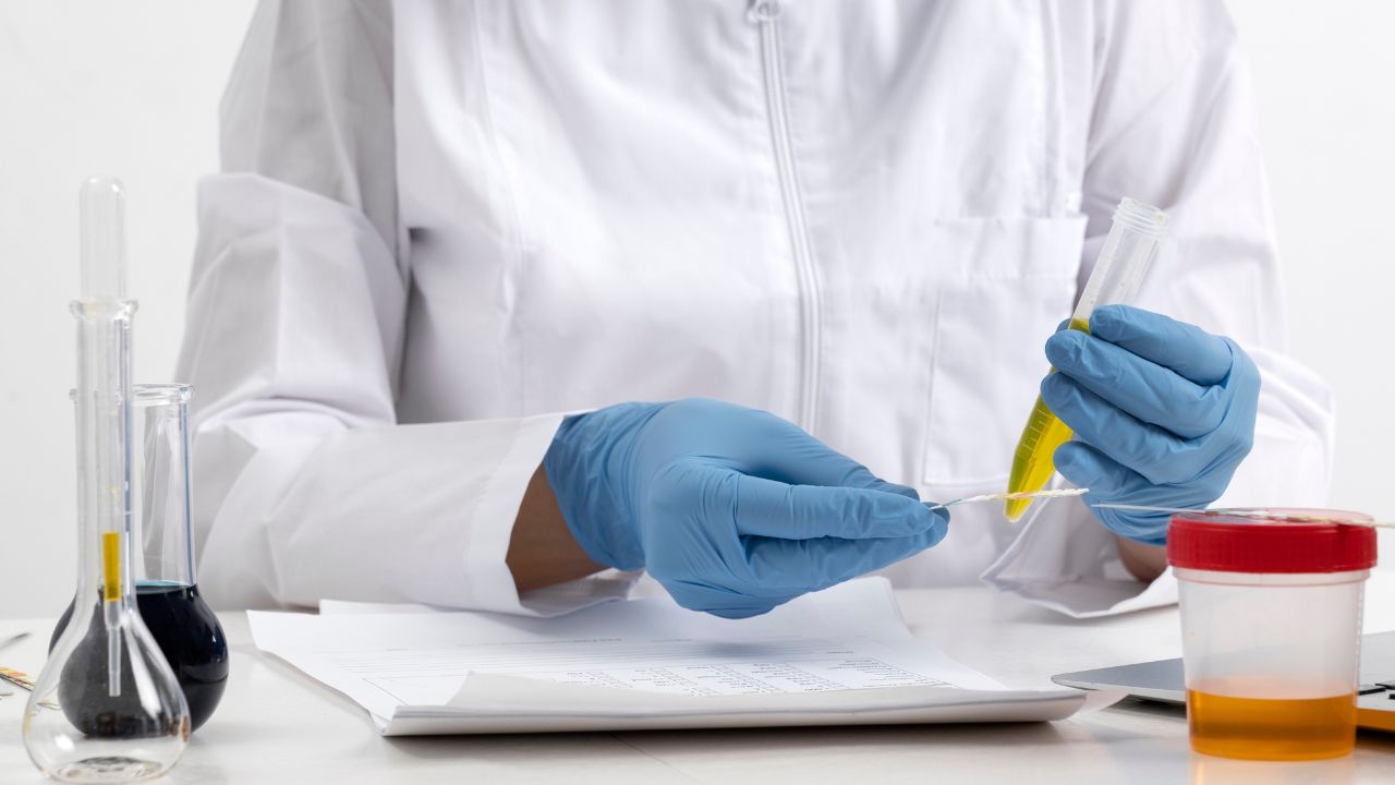 análises clínicas urinálise e parasitologia