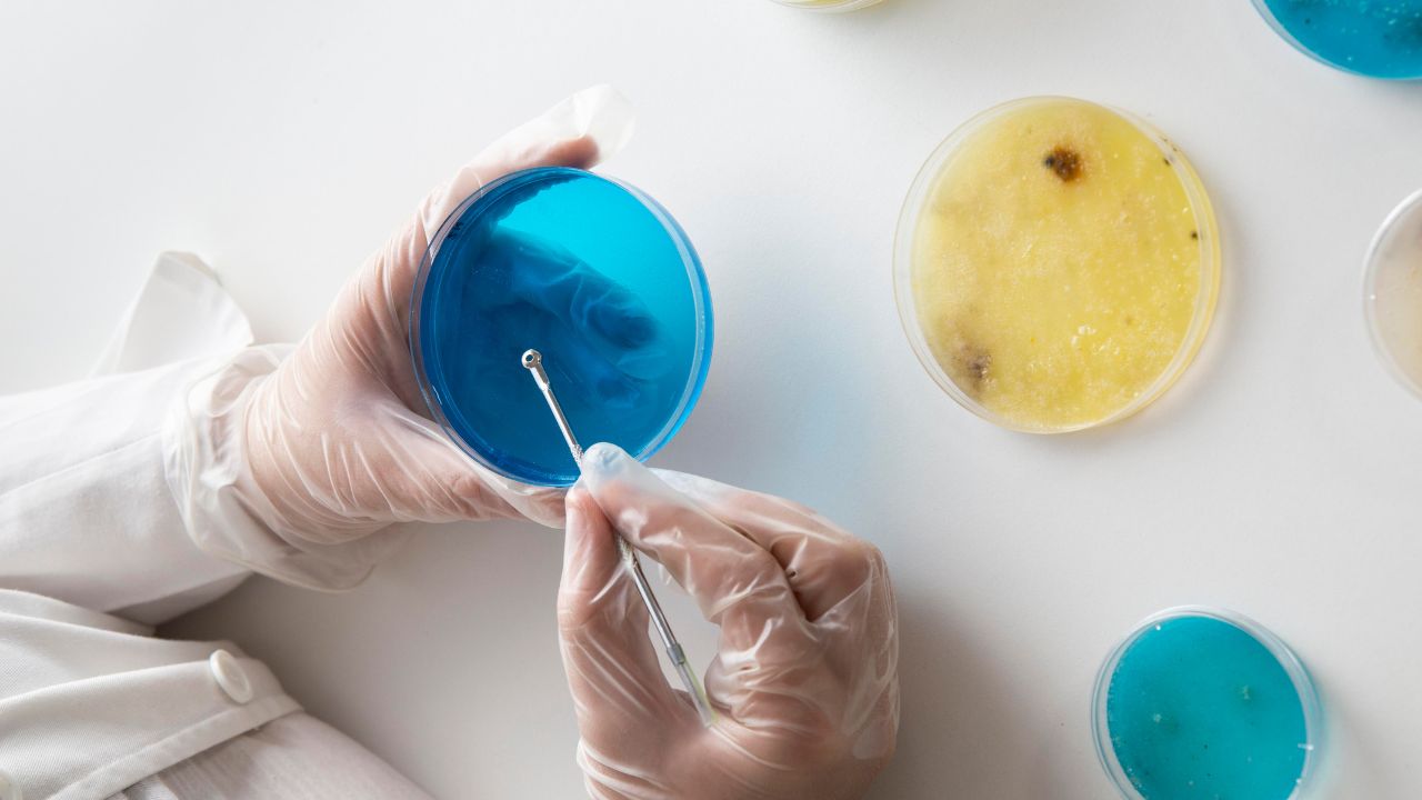 exame parasitológico de fezes