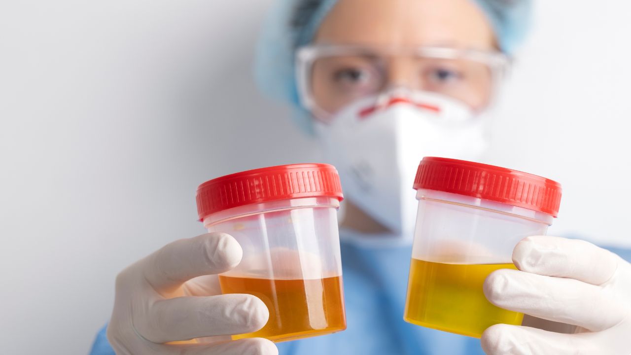 o que é parasitologico de fezes