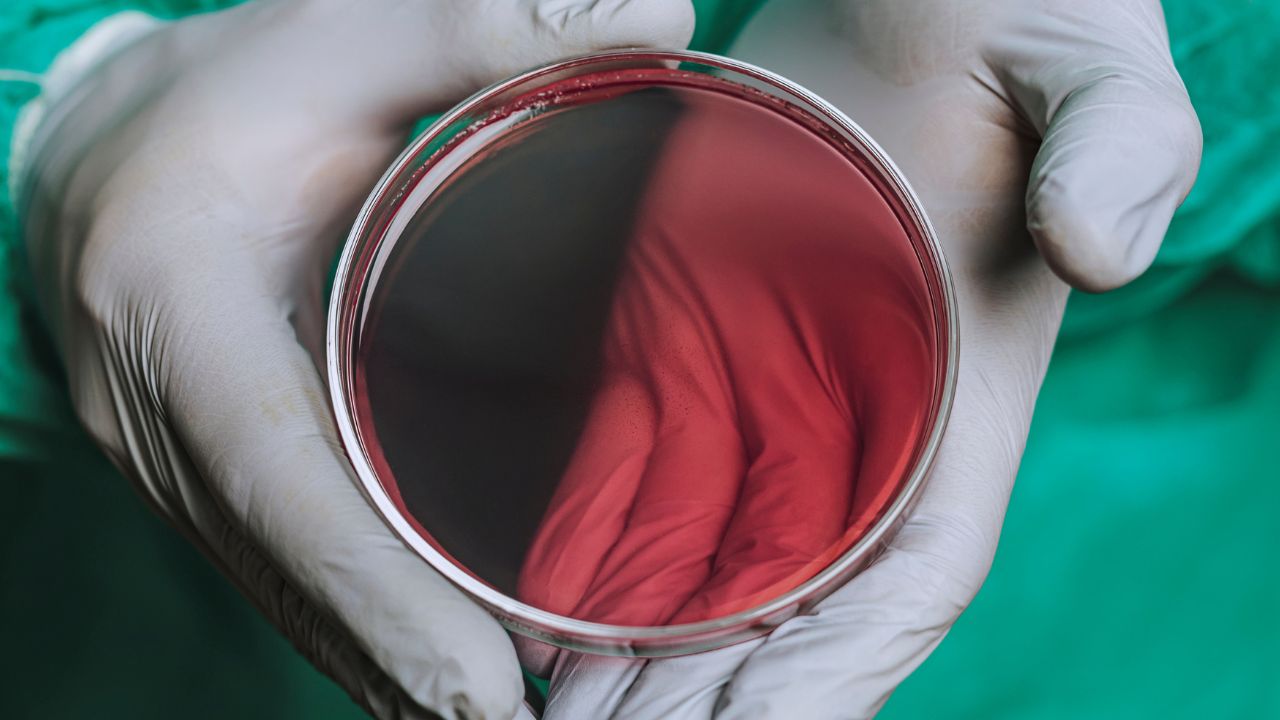 parasitologico de fezes