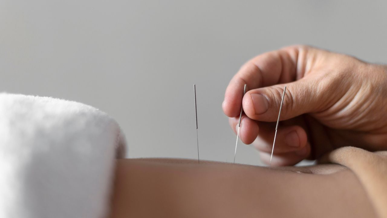 imagem sobre Terapia Ocupacional em Acupuntura: guia completo sobre fundamentos, aplicações e benefícios