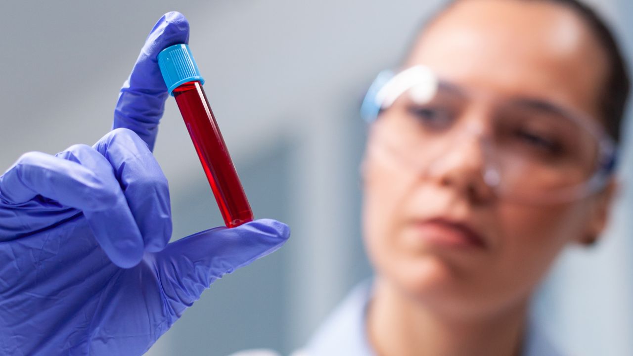 Enfermagem em Hematologia Clínica